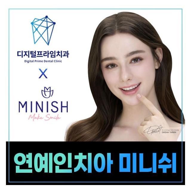 자연스러운 치아 복원 솔루션 연예인 치아 미니쉬